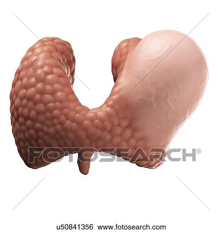 Stock Illustration - Thyroid gland cancer, artwork. Fotosearch