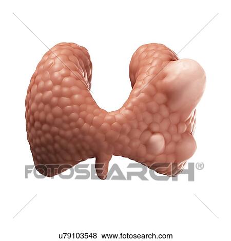 Thyroid gland cancer, artwork View Large Illustration Stock Illustration - Thyroid gland cancer, artwork. Fotosearch