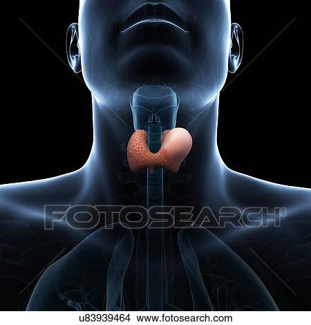 Thyroid gland cancer, artwork View Large Illustration Stock Illustration - Thyroid gland cancer, artwork. Fotosearch