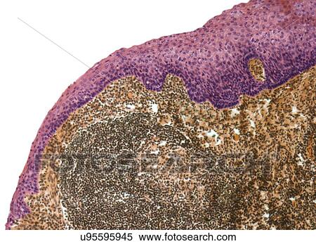 Tonsil, light micrograph View Large Illustration Stock Illustration - Tonsil, light micrograph. Fotosearch