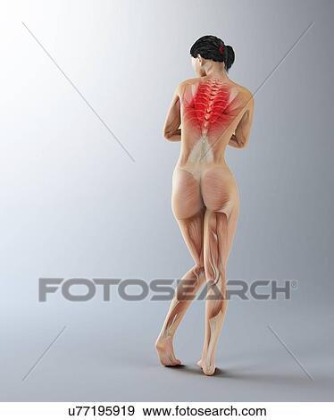 Upper back pain, conceptual artwork View Large Illustration Stock Illustration - Upper back pain, conceptual artwork. Fotosearch