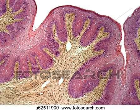 Clipart - Vaginal mucosa, light micrograph. Fotosearch
