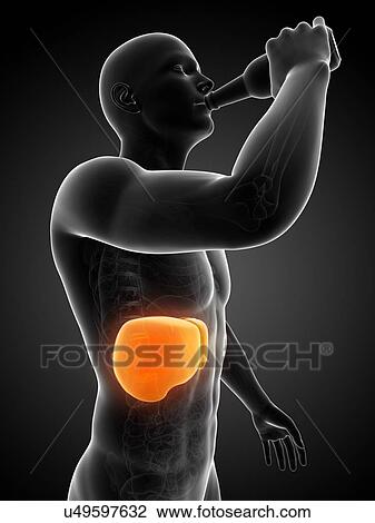 Alcoholic liver disease, artwork View Large Illustration Drawing - Alcoholic liver disease, artwork. Fotosearch