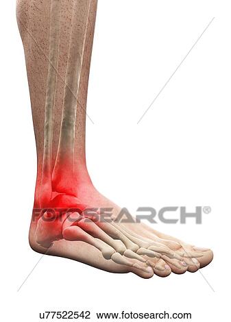 Ankle pain, conceptual artwork View Large Illustration Drawing - Ankle pain, conceptual artwork. Fotosearch