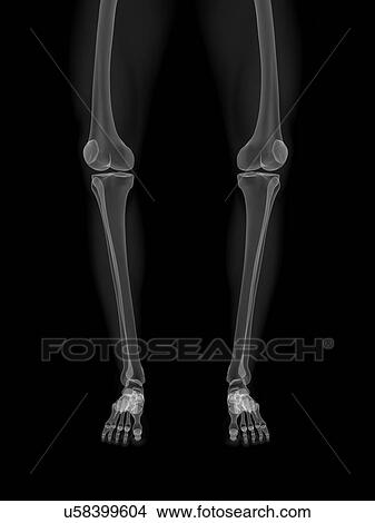 Stock Illustration - Bowed legs, artwork. Fotosearch