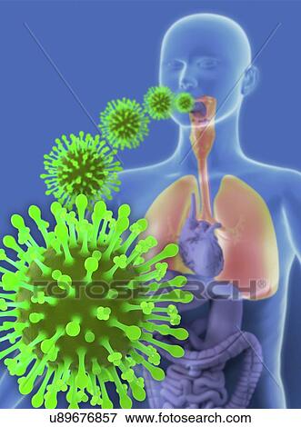 Flu infection, artwork View Large Illustration Stock Illustration - Flu infection, artwork. Fotosearch