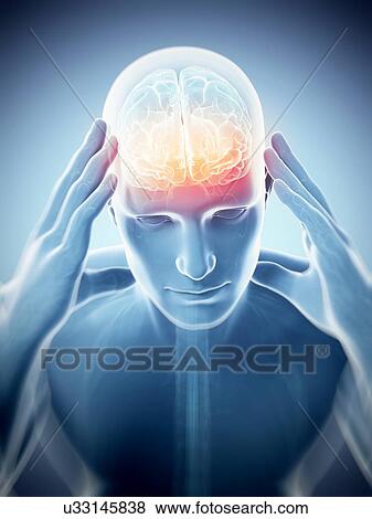 Stock Illustration - Headache, artwork. Fotosearch