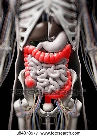 Inflamed colon, artwork View Large Illustration Stock Illustration - Inflamed colon, artwork. Fotosearch