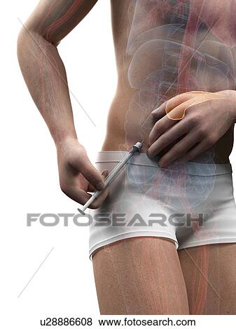 Insulin injection, artwork View Large Illustration Stock Illustration - Insulin injection, artwork. Fotosearch