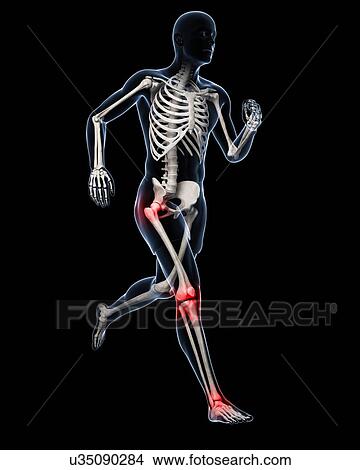 Stock Illustration - Joint pain, conceptual artwork. Fotosearch