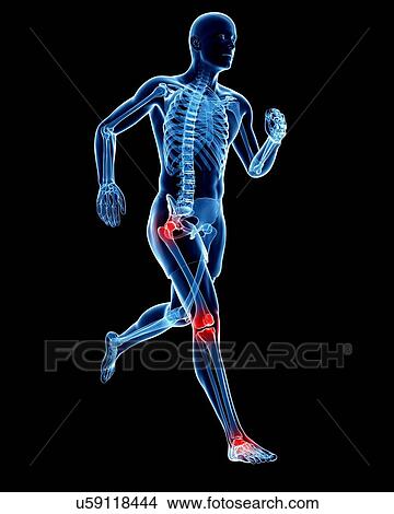 Stock Illustration - Joint pain, conceptual artwork. Fotosearch