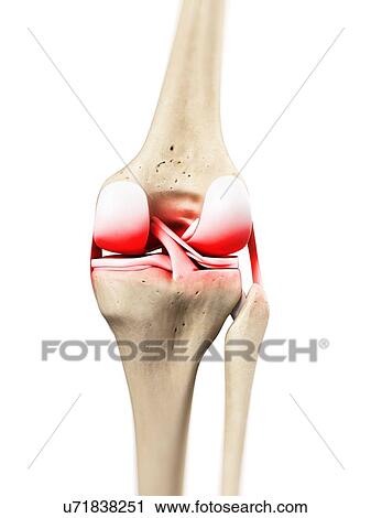 Knee pain, conceptual artwork View Large Illustration Clip Art - Knee pain, conceptual artwork. Fotosearch