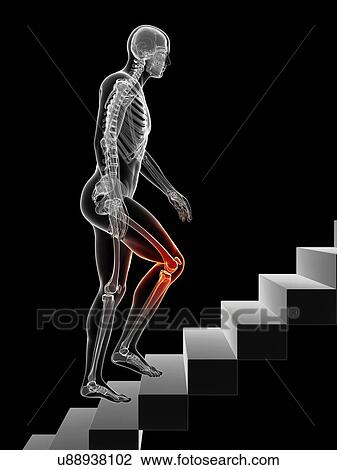 Drawing - Knee pain, conceptual artwork. Fotosearch
