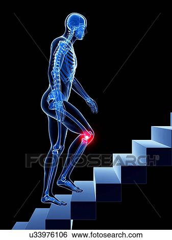 Knee pain, conceptual artwork View Large Illustration Stock Illustration - Knee pain, conceptual artwork. Fotosearch