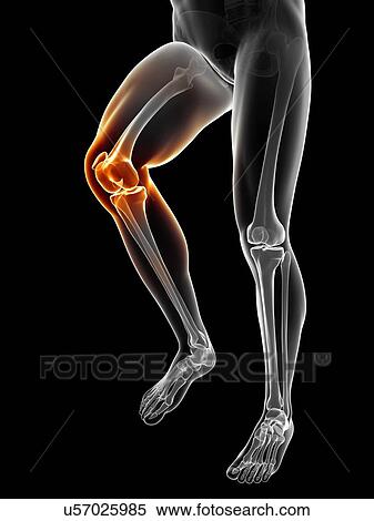 Knee pain, conceptual artwork View Large Illustration Stock Illustration - Knee pain, conceptual artwork. Fotosearch