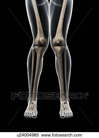 Stock Illustration - Knock knee, artwork. Fotosearch