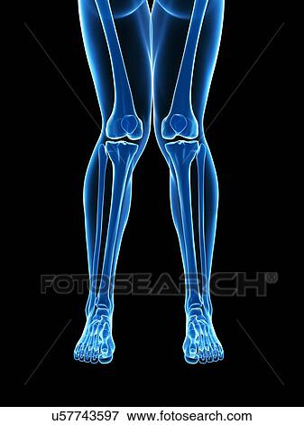 Stock Illustration - Knock knee, artwork. Fotosearch