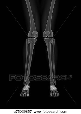 Stock Illustration - Knock knee, artwork. Fotosearch