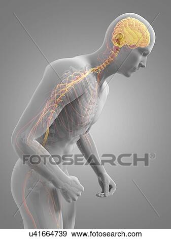 Stock Illustration - Parkinson's disease, conceptual artwork. Fotosearch