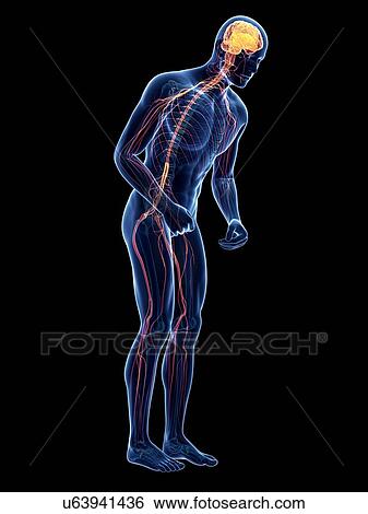Stock Illustration - Parkinson's disease, conceptual artwork. Fotosearch