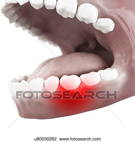 Toothache, conceptual artwork View Large Illustration Drawing - Toothache, conceptual artwork. Fotosearch