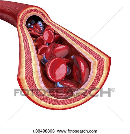 Human artery, artwork View Large Illustration Drawing - Human artery, artwork. Fotosearch