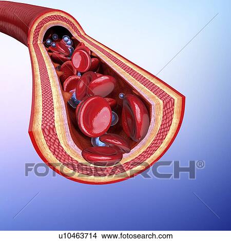 Stock Illustration - Human artery, artwork. Fotosearch
