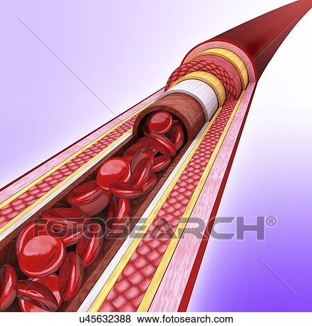 Stock Illustration - Human artery, artwork. Fotosearch