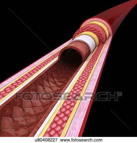 Stock Illustration - Human artery, artwork. Fotosearch