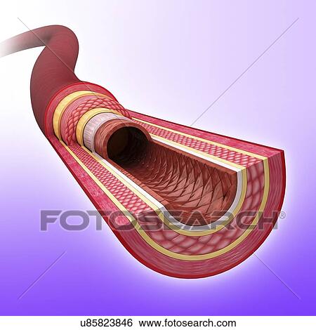 Stock Illustration - Human artery, artwork. Fotosearch