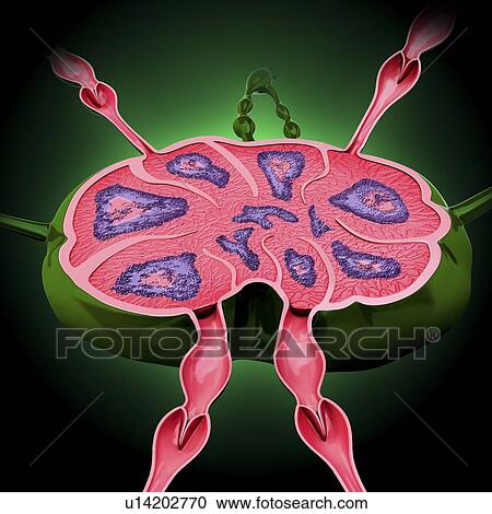Clipart - Human lymph node, artwork. Fotosearch