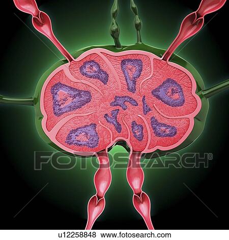Human lymph node, artwork View Large Illustration Stock Illustration - Human lymph node, artwork. Fotosearch