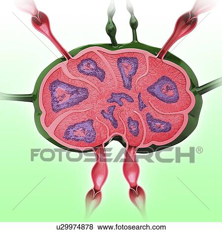 Human lymph node, artwork View Large Illustration Stock Illustration - Human lymph node, artwork. Fotosearch