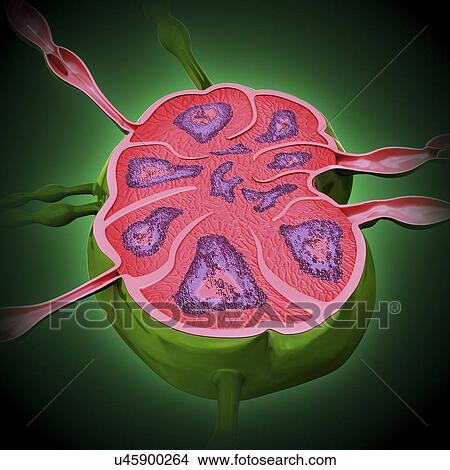 Human lymph node, artwork View Large Illustration Stock Illustration - Human lymph node, artwork. Fotosearch