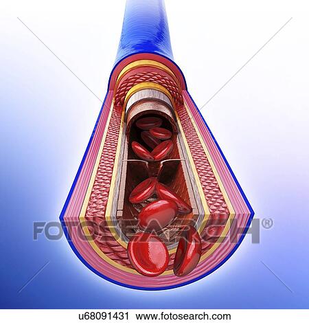 Clip Art - Human vein, artwork. Fotosearch
