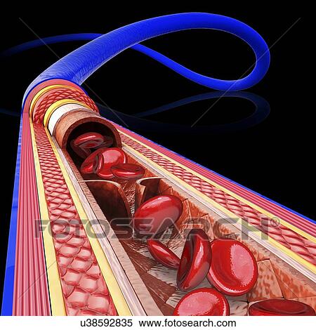 Human vein, artwork View Large Illustration Stock Illustration - Human vein, artwork. Fotosearch