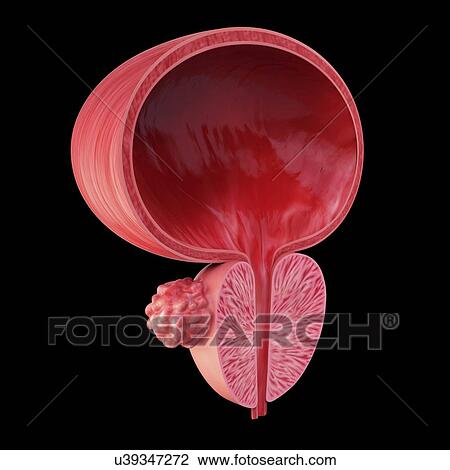 Drawing - Prostate gland tumour, artwork. Fotosearch