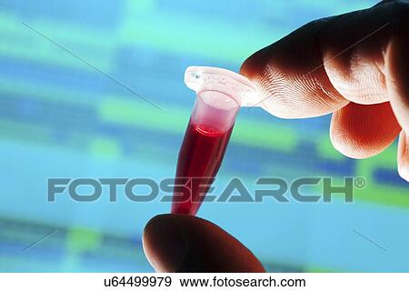 Stock Illustration - Blood sample. Fotosearch