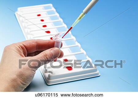 Blood sample View Large Illustration Stock Illustration - Blood sample. Fotosearch