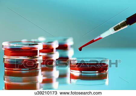 Drawing - Blood testing. Fotosearch