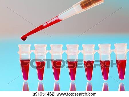 Drawing - Blood testing. Fotosearch