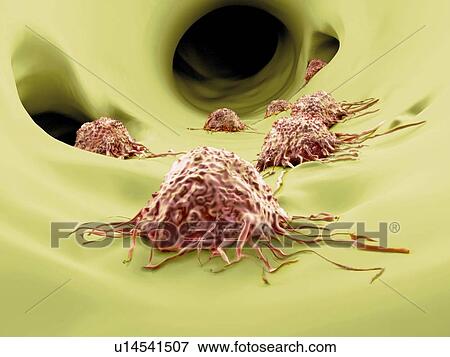 Cancer cells, artwork View Large Illustration Stock Illustration - Cancer cells, artwork. Fotosearch