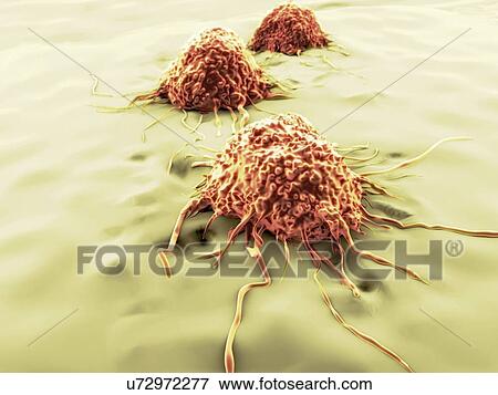 Cancer cells, artwork View Large Illustration Stock Illustration - Cancer cells, artwork. Fotosearch