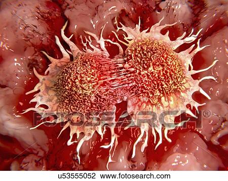 Cancer cells dividing, artwork View Large Illustration Drawing - Cancer cells dividing, artwork. Fotosearch
