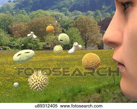 Hay fever, artwork View Large Illustration Stock Illustration - Hay fever, artwork. Fotosearch