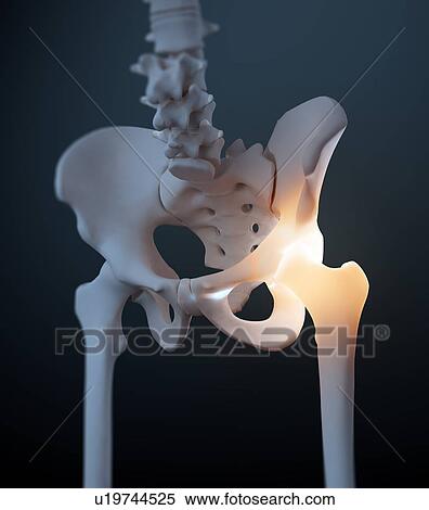 Hip and pelvis pain, artwork View Large Illustration Stock Illustration - Hip and pelvis pain, artwork. Fotosearch