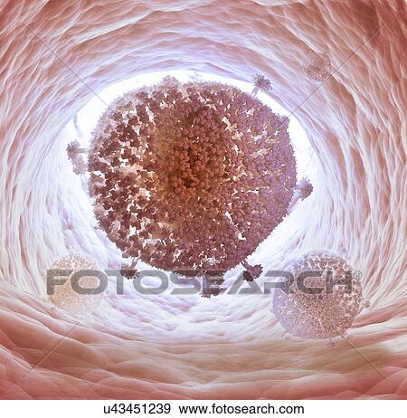 HIV, artwork View Large Illustration Stock Illustration - HIV, artwork. Fotosearch