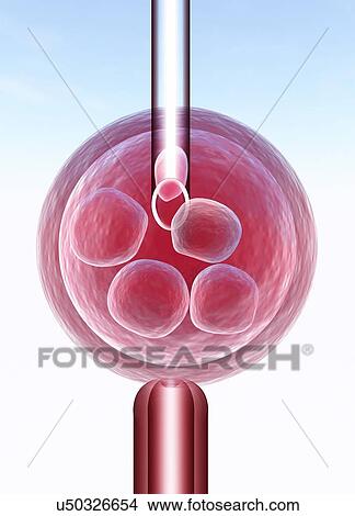 IVF, artwork View Large Illustration Stock Illustration - IVF, artwork. Fotosearch