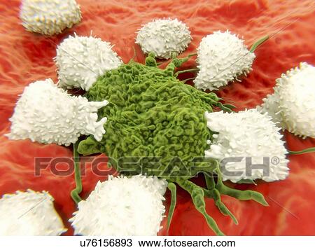 Lymphocytes and cancer cell View Large Illustration Drawing - Lymphocytes and cancer cell. Fotosearch