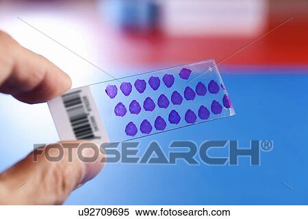 Microscope slide View Large Illustration Stock Illustration - Microscope slide. Fotosearch